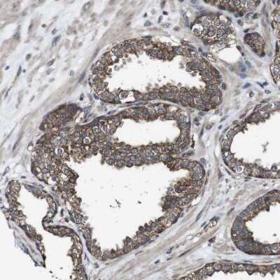 Immunohistochemistry-Paraffin: BTN3A3 Antibody [NBP1-88510]