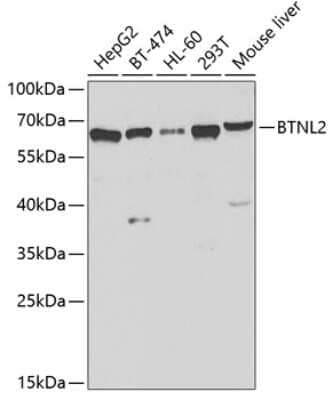 Western Blot: BTNL2/Butyrophilin-like 2 AntibodyAzide and BSA Free [NBP2-92488]