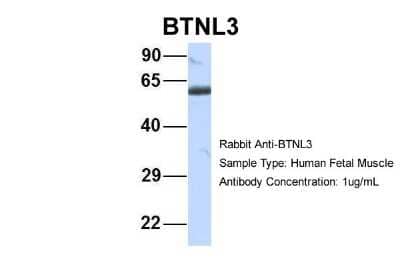 Western Blot: BTNL3 Antibody [NBP1-69346]