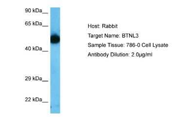 Western Blot: BTNL3 Antibody [NBP2-86591]