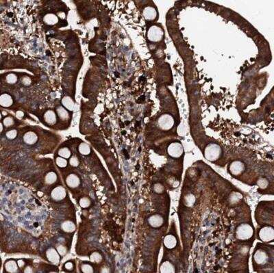 Immunohistochemistry-Paraffin: BTNL8 Antibody [NBP2-14368]