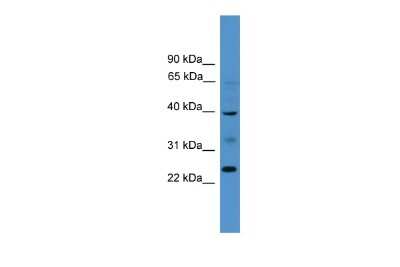 Western Blot: BTNL8 Antibody [NBP3-10607]