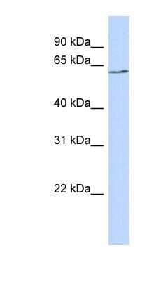 Western Blot: BTNL9 Antibody [NBP1-91437]