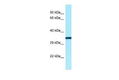 Western Blot: BTNL9 Antibody [NBP2-83955]