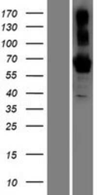 Western Blot: BTNL9 Overexpression Lysate [NBP2-05343]