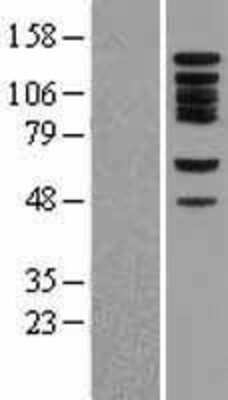 Western Blot: Bub1 Overexpression Lysate [NBL1-08056]