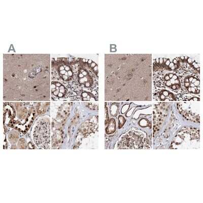 Immunohistochemistry-Paraffin: BUD13 Antibody [NBP1-81863]