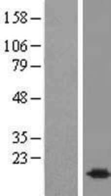 Western Blot: BUD31 Overexpression Lysate [NBL1-08060]