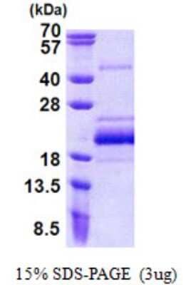 SDS-PAGE: Recombinant Human BUD31 His Protein [NBP2-22720]