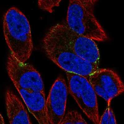 Immunocytochemistry/ Immunofluorescence: BVES Antibody [NBP1-83286]