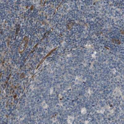 Immunohistochemistry-Paraffin: BVES Antibody [NBP1-83286]