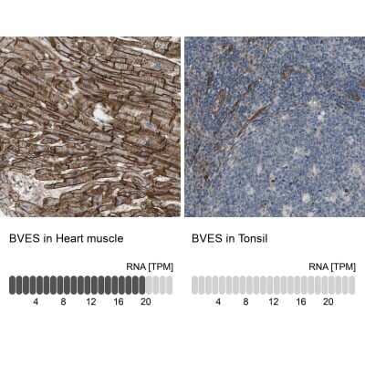 Immunohistochemistry-Paraffin: BVES Antibody [NBP1-83286]
