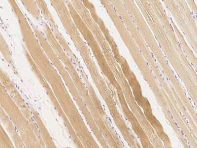 Immunohistochemistry-Paraffin: BVES Antibody [NBP2-98934]