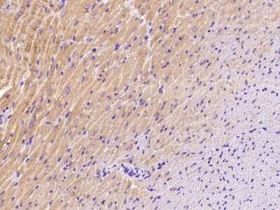 Immunohistochemistry-Paraffin: BVES Antibody [NBP2-99427]