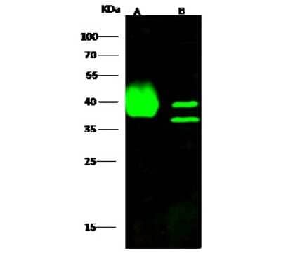 Western Blot: BVES Antibody [NBP2-98934]