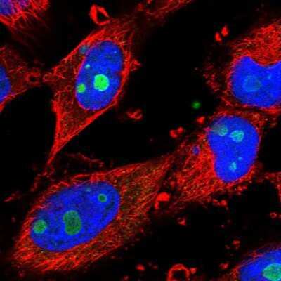 Immunocytochemistry/ Immunofluorescence: BXDC1 Antibody [NBP1-90031]