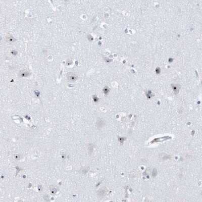 Immunohistochemistry-Paraffin: BXDC1 Antibody [NBP1-90031]