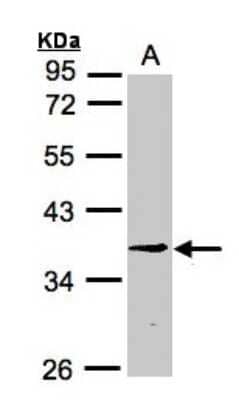 Western Blot: BXDC1 Antibody [NBP1-32613]