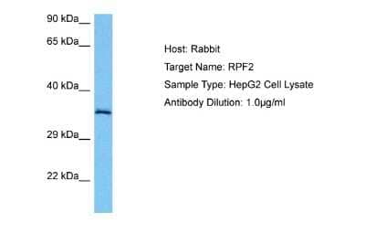 Western Blot: BXDC1 Antibody [NBP2-87097]