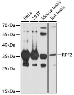 Western Blot: BXDC1 AntibodyAzide and BSA Free [NBP2-92352]