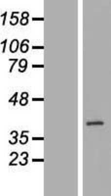 Western Blot: BXDC1 Overexpression Lysate [NBL1-08061]