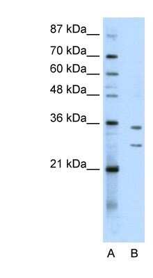 Western Blot: BXDC5 Antibody [NBP1-80467]