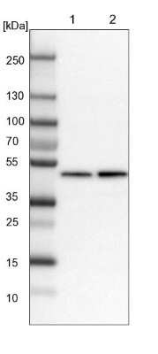 Western Blot: BXDC5 Antibody [NBP1-89915]