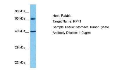 Western Blot: BXDC5 Antibody [NBP2-84528]