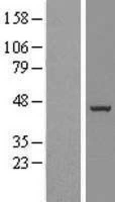 Western Blot: BXDC5 Overexpression Lysate [NBL1-08063]