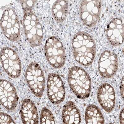 Immunohistochemistry-Paraffin: BYSL Antibody [NBP1-89501]