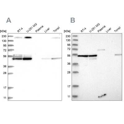 Western Blot: BYSL Antibody [NBP1-89500]