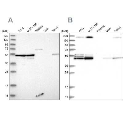 Western Blot: BYSL Antibody [NBP1-89501]