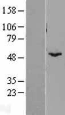 Western Blot: BYSL Overexpression Lysate [NBL1-08064]