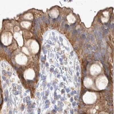 Immunohistochemistry-Paraffin: BZRAP1 Antibody [NBP1-93626]