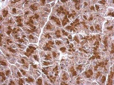Immunohistochemistry-Paraffin: BZW2 Antibody [NBP1-32519]
