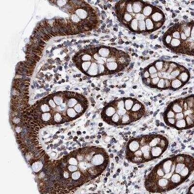 Immunohistochemistry-Paraffin: BZW2 Antibody [NBP1-83183]
