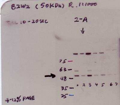 Western Blot: BZW2 Antibody [NBP1-32519]