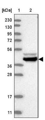 Western Blot: BZW2 Antibody [NBP1-83182]