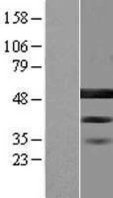 Western Blot: BZW2 Overexpression Lysate [NBL1-08066]