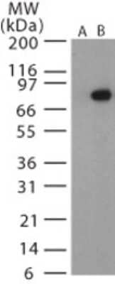 Western Blot: Bacillus anthracis protective antigen Antibody [NB120-13808]