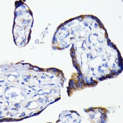Immunohistochemistry-Paraffin: Bad Antibody (1I10A2) [NBP3-15801]