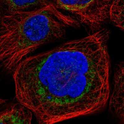 Immunocytochemistry/ Immunofluorescence: Bad Antibody [NBP1-88698]