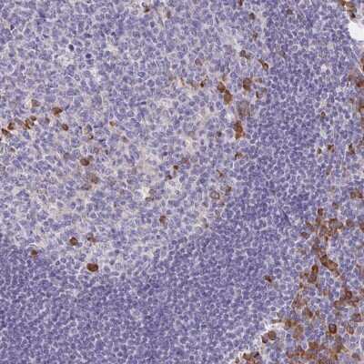 Immunohistochemistry: Bad Antibody [NBP2-38947]