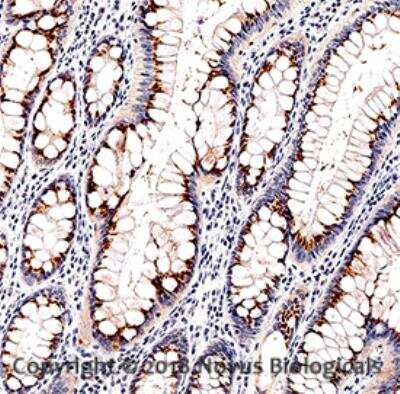 Immunohistochemistry-Paraffin: Bad Antibody - Mouse Adsorbed [NB100-56078]