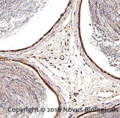 Immunohistochemistry-Paraffin: Bad Antibody [NB100-56079]