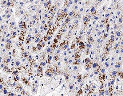 Immunohistochemistry-Paraffin: Bad Antibody [NB100-56080]