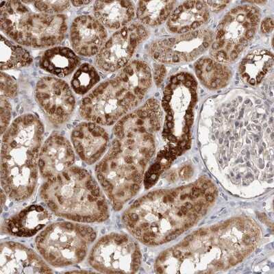 Immunohistochemistry-Paraffin: Bad Antibody [NBP1-88698]