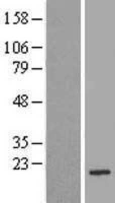 Western Blot: Bad Overexpression Lysate [NBL1-07900]