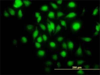 Immunocytochemistry/ Immunofluorescence: Bag-1 Antibody (2D3) [H00000573-M02]