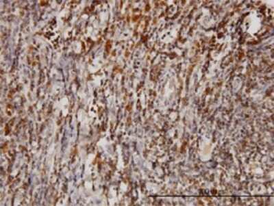 Immunohistochemistry-Paraffin: Bag-1 Antibody (2D3) [H00000573-M02]